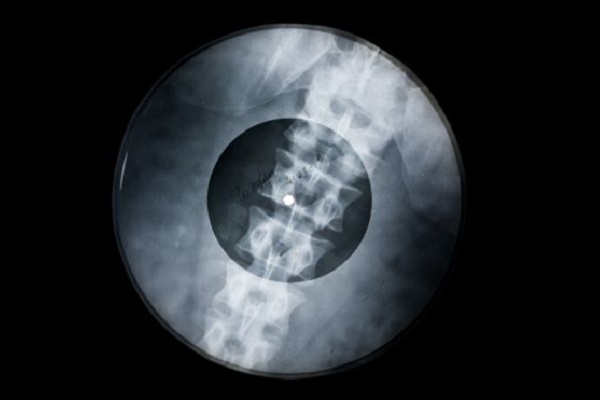 Выставка «Музыка на костях»