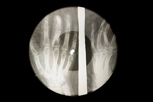 Выставка «Музыка на костях»